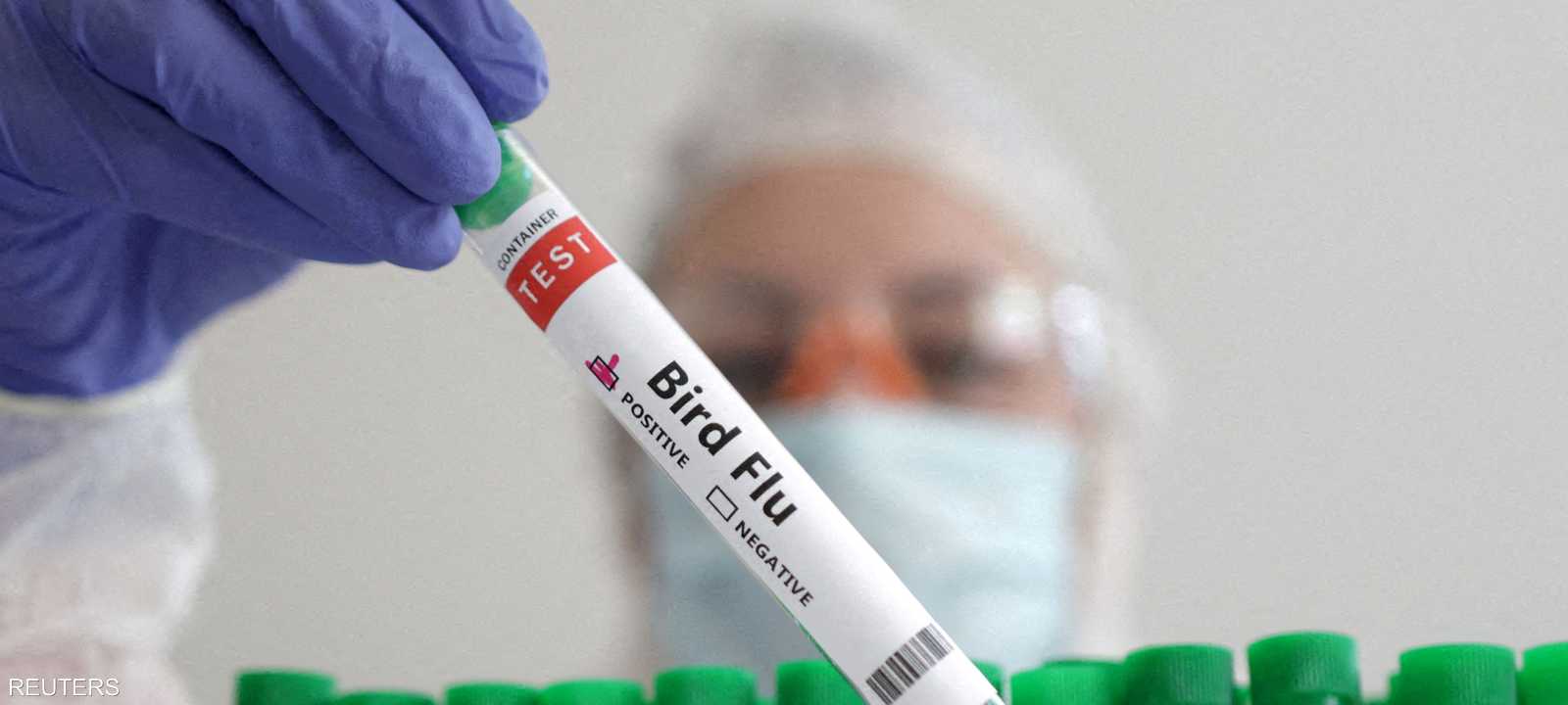 كولورادو أبلغت عن ثلاث حالات إصابة محتملة..أرشيفية