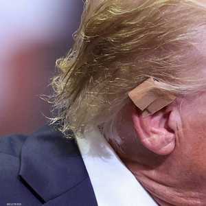 ترامب أصيب في أذنه أثناء محاولة الاغتيال