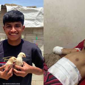 ضياء يتذكر كابوس فقد ذراعيه في قصف إسرائيلي