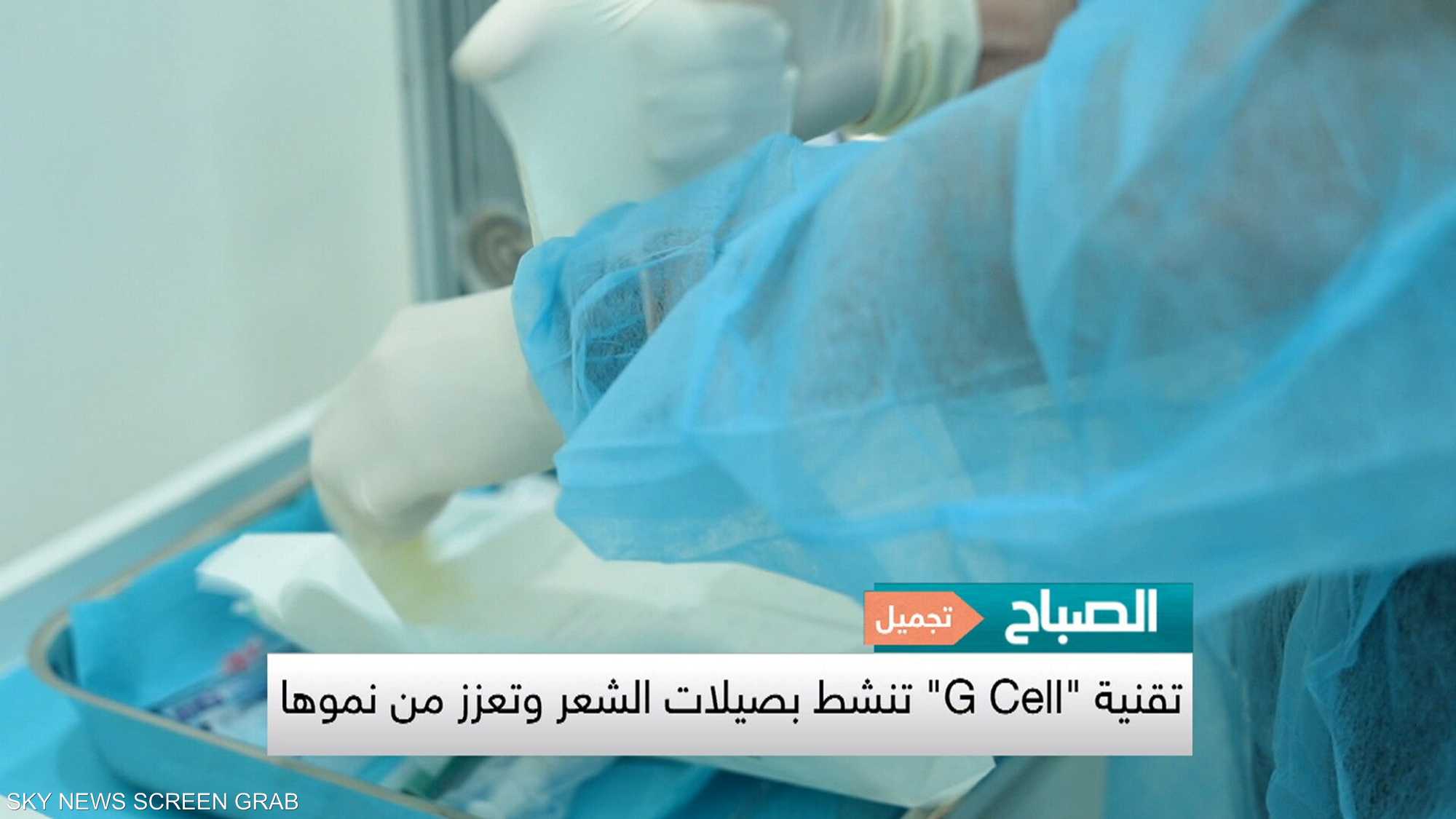 تقنية "G Cell" لإعادة نمو الشعر ومنعه من التساقط