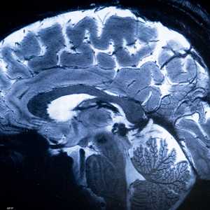 المخ البشري يغتسل أثناء النوم