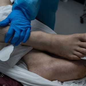 علاقة نعومة الأرجل بالأزمات القلبية