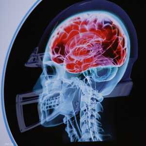 الإصابات المتكررة تنشط فيروس "الهيربس البسيط"