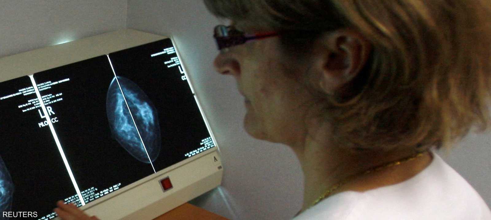 أخصائية تقيّم صورة أشعة خاصة باختبار لسرطان الثدي
