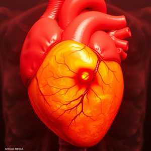 أمراض القلب تُعد من أكثر الأمراض انتشارا