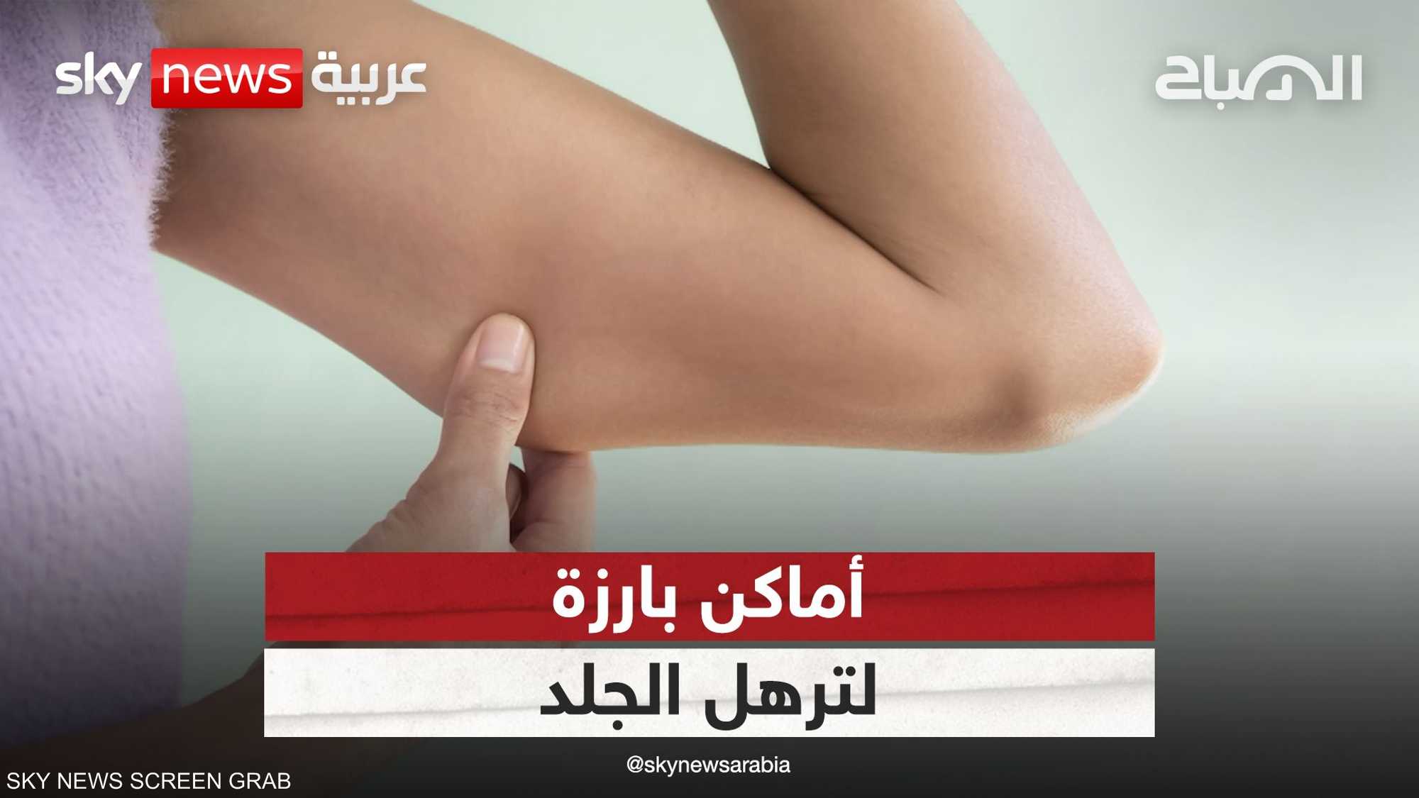 وداعا للترهلات..تقنيات شد الجلد في الذراعين والجسم