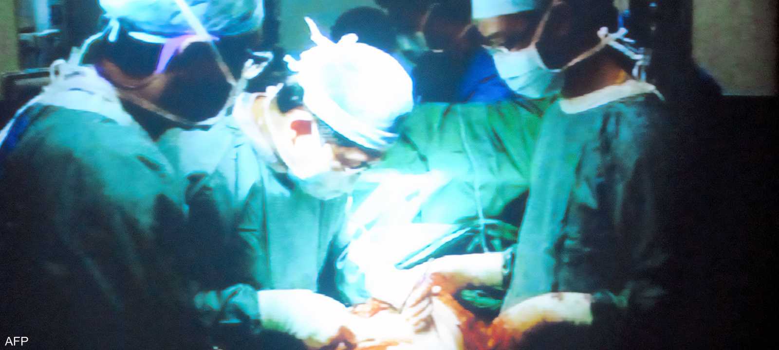 أطباء يجرون عملية زراعة كبد