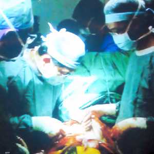 أطباء يجرون عملية زراعة كبد