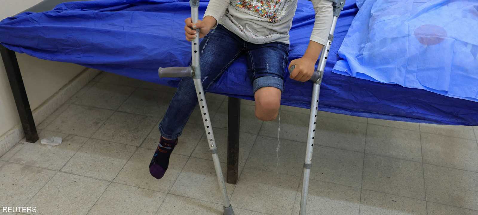 محنة مبتوري الأطراف في غزة.. معاناة لا تنتهي