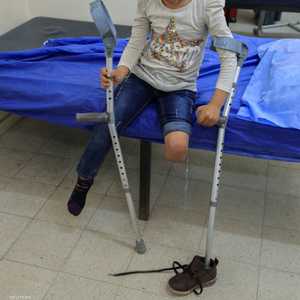 محنة مبتوري الأطراف في غزة.. معاناة لا تنتهي