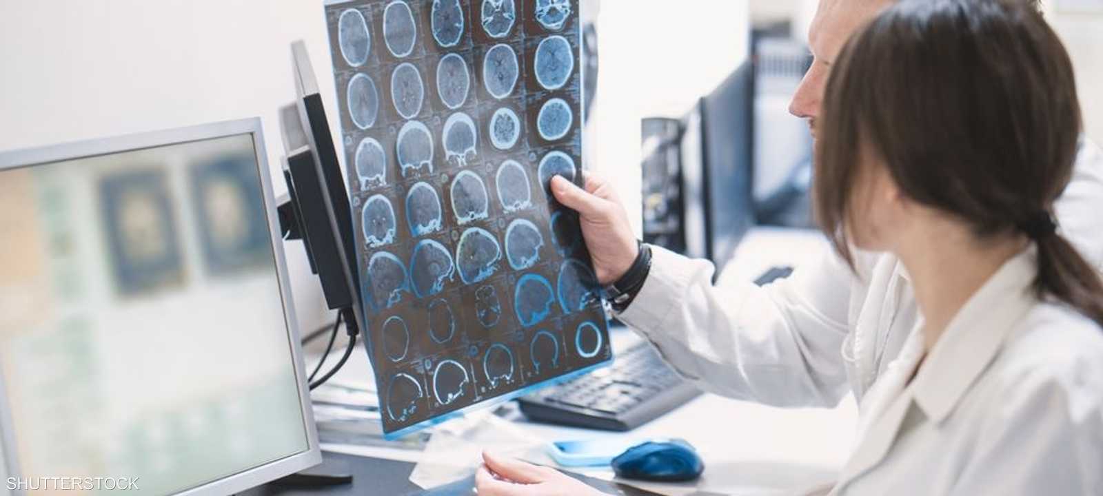 يصيب الزهايمر ملايين الأشخاص حول العالم.. أرشيفية