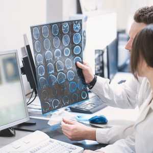 يصيب الزهايمر ملايين الأشخاص حول العالم.. أرشيفية