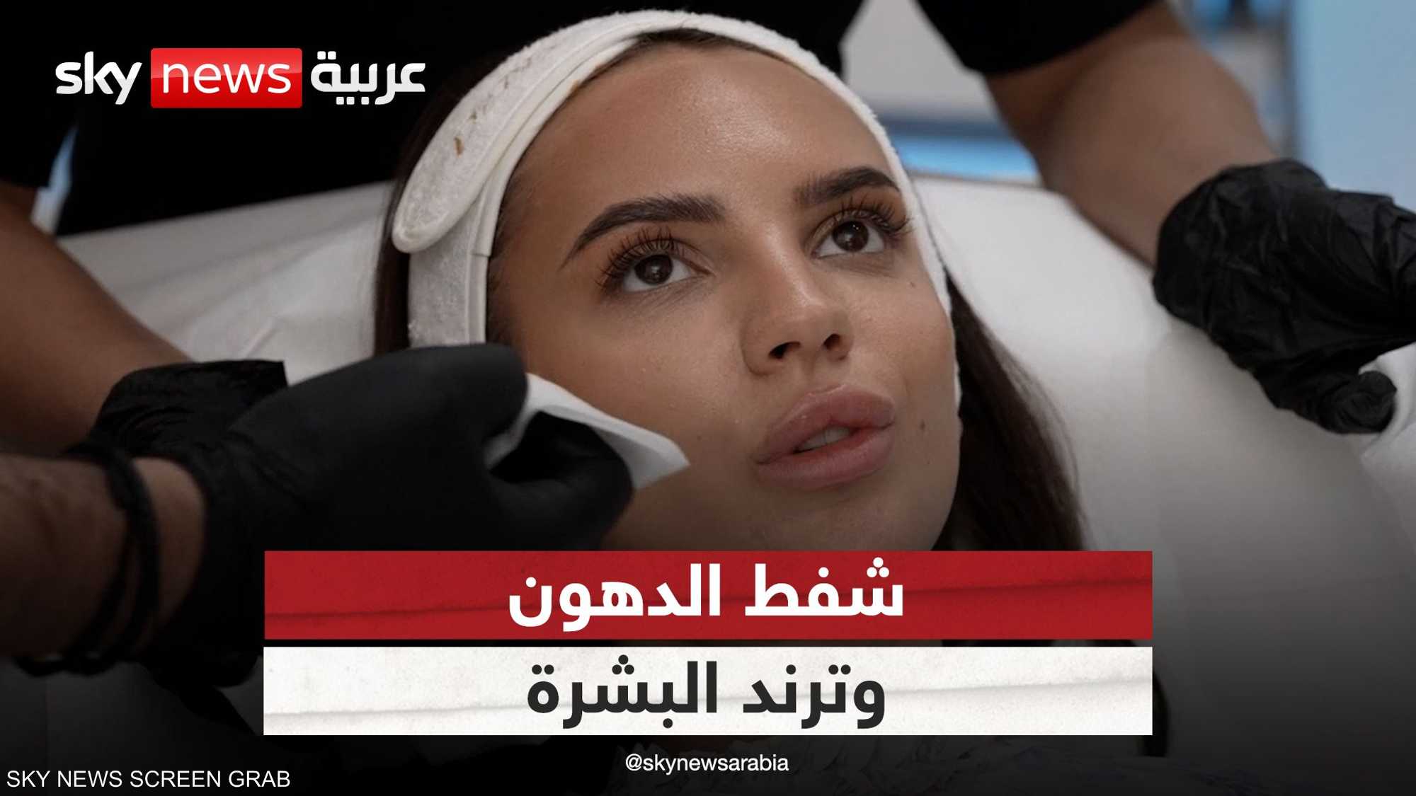 شفط الدهون وترند البشرة حديث "كلينيك" هذا الأسبوع