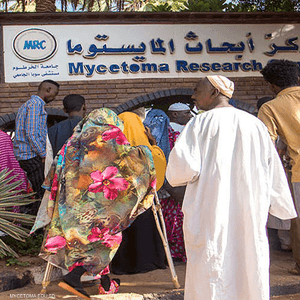 المركز الوحيد في العالم لأبحاث المايستوما