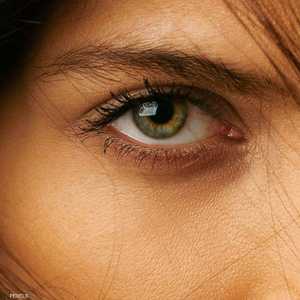 تجربة لعلاج التنكس البقعي في العين.. أرشيفية