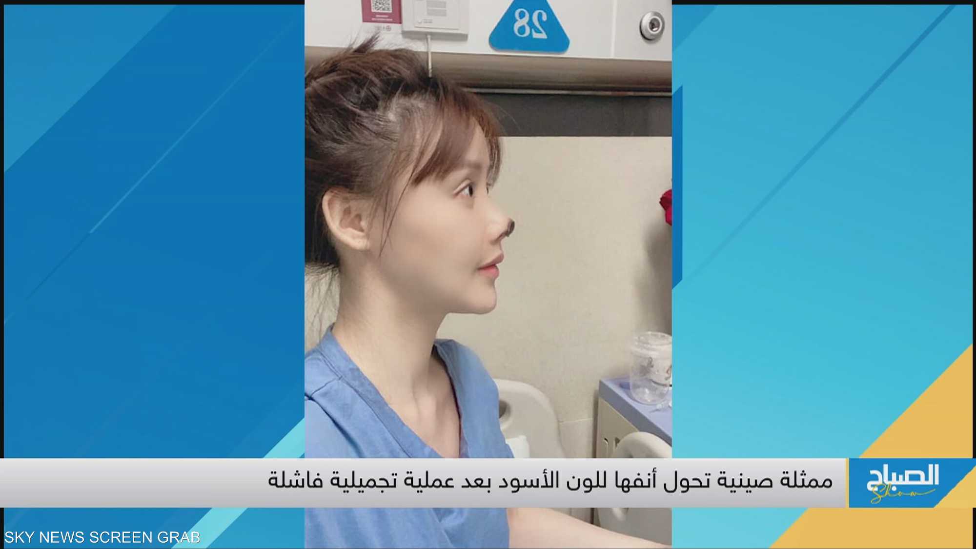 نجمة صينية ضحية "كبير الجراحين"