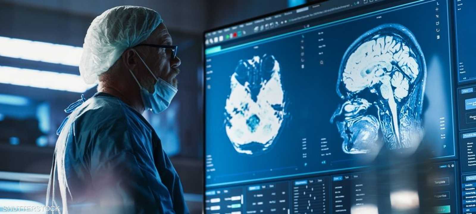 الوعي قد لا ينشأ في الجزء "الذكي" من الدماغ.. أرشيفية