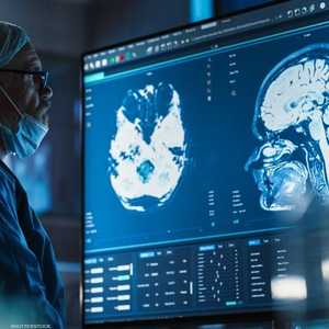 الوعي قد لا ينشأ في الجزء "الذكي" من الدماغ.. أرشيفية