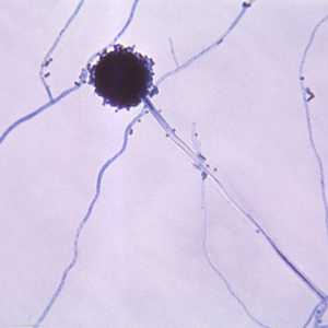 فطريات "أسبرغيلوس"