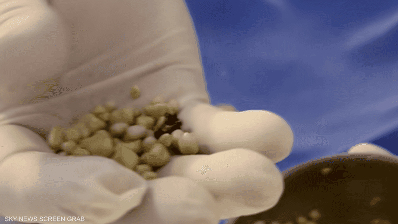 حدد الطبيب سبب الحصوات بكثرة شرب المشروبات الغازية