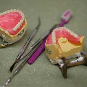 نسبة كبيرة من كبار السن يفقدون أسنانهم تماما مع تقدم العمر