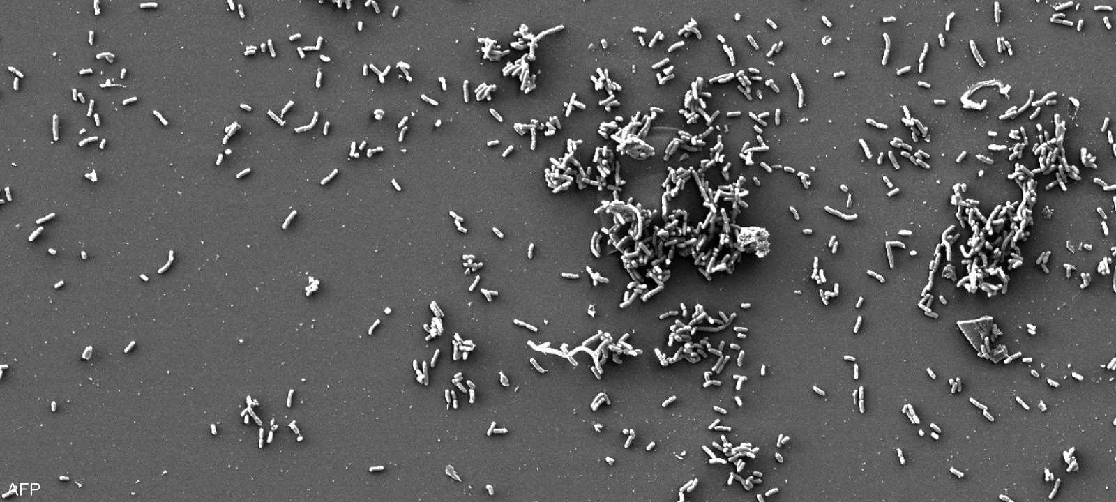 رصدت أدلة على وجود بكتيريا الطاعون قبل نحو 5500 عام