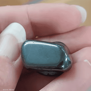 خضع الطفل لعملية جراحية عاجلة لإزالة المغناطيسين