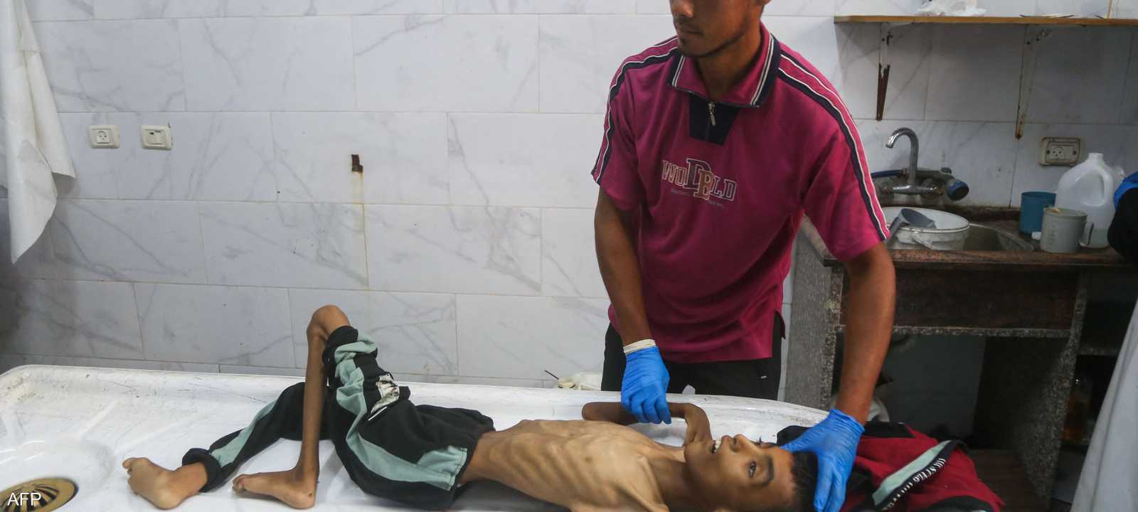 معاناة صحية لأطفال غزة تحت الحصار الخانق