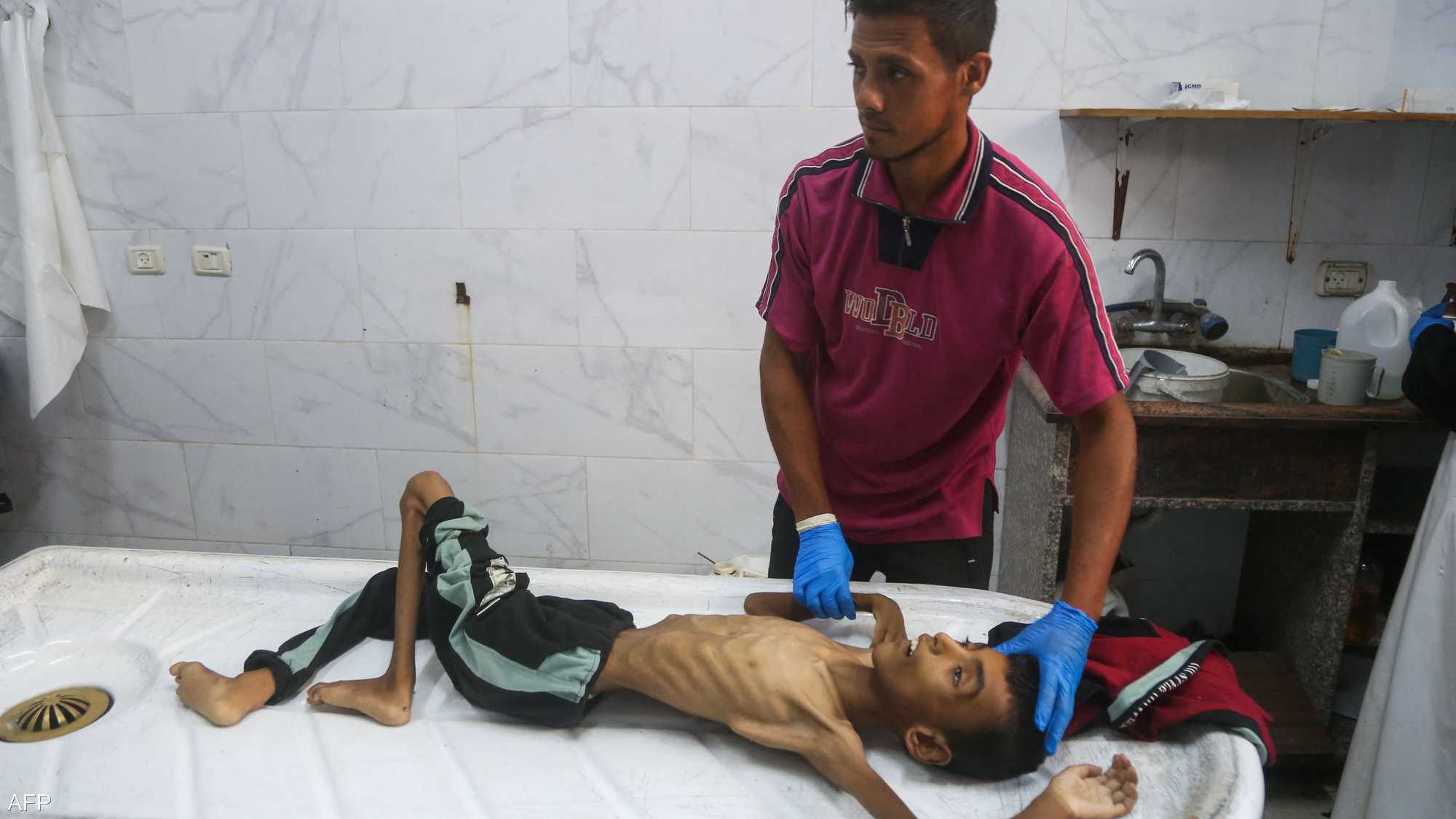 معاناة صحية لأطفال غزة تحت الحصار الخانق