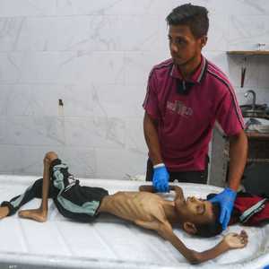 معاناة صحية لأطفال غزة تحت الحصار الخانق