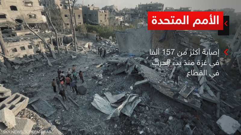 إصابة أكثر من 157 ألفا في غزة منذ بدء الحرب في القطاع