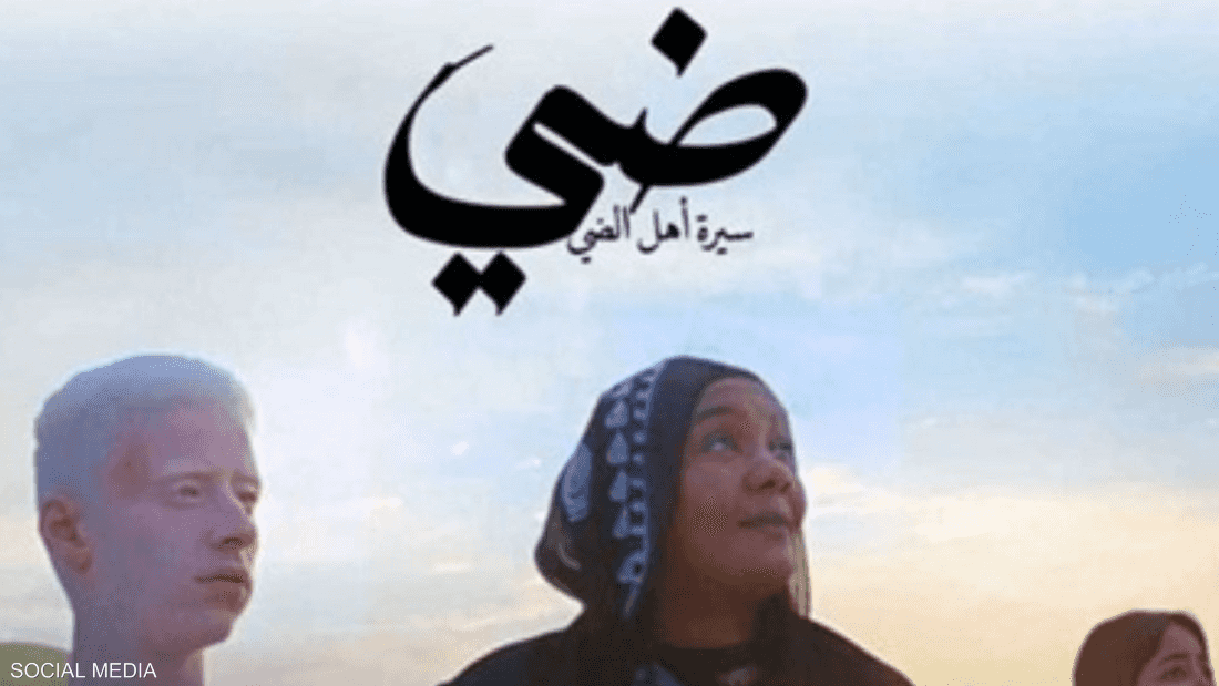 خاص
مصر.. فيلم ضي يتناول مرض "الألبينو" بمشاركة محمد منير
