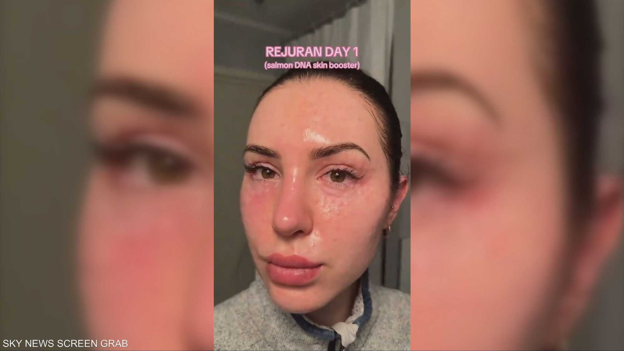 "رجوران".. منتج تجميل كوري يجتاح تيك توك وأطباء يشككون فيه