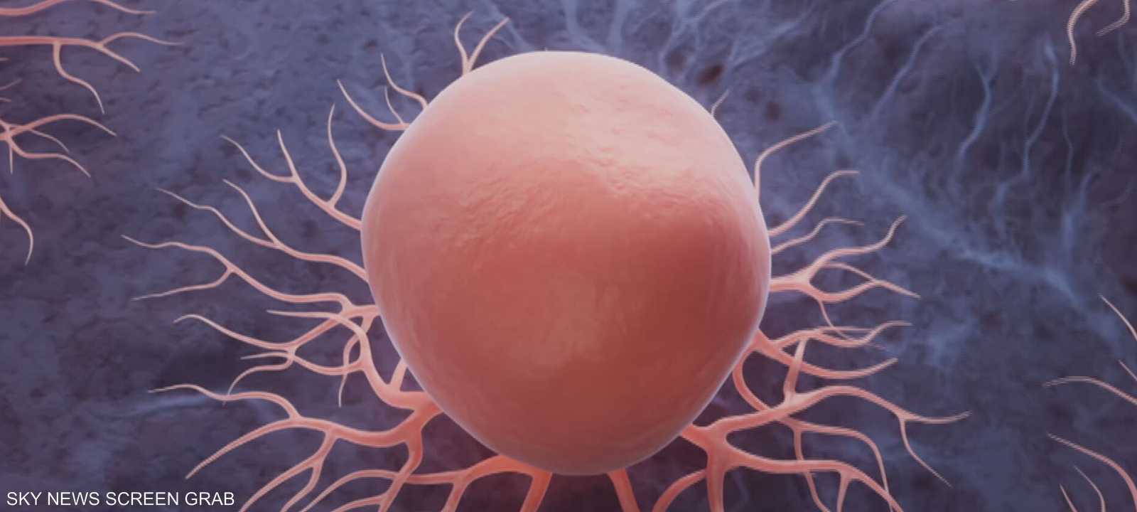 اكتشافات طبية تبشر باختفاء "شبح مرض السرطان" نهائيا