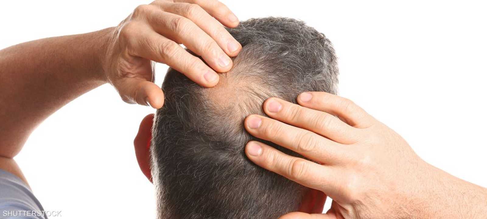 زيت بذور اليقطين يمكن أن يساعد على إيقاف تساقط الشعر.. أرشيف