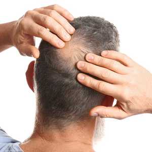 زيت بذور اليقطين يمكن أن يساعد على إيقاف تساقط الشعر.. أرشيف