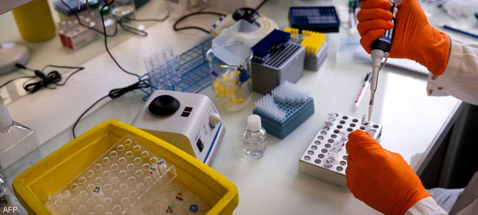 دراسة تكشف الدور المزدوج لإنزيم HSL في استقلاب الدهون