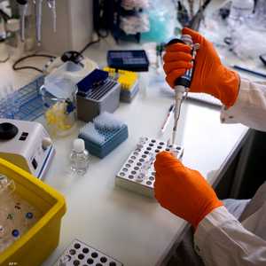 دراسة تكشف الدور المزدوج لإنزيم HSL في استقلاب الدهون