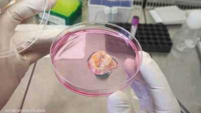 مركز أبوظبي للخلايا الجذعية يطلق علاجا مبتكرا للسرطان