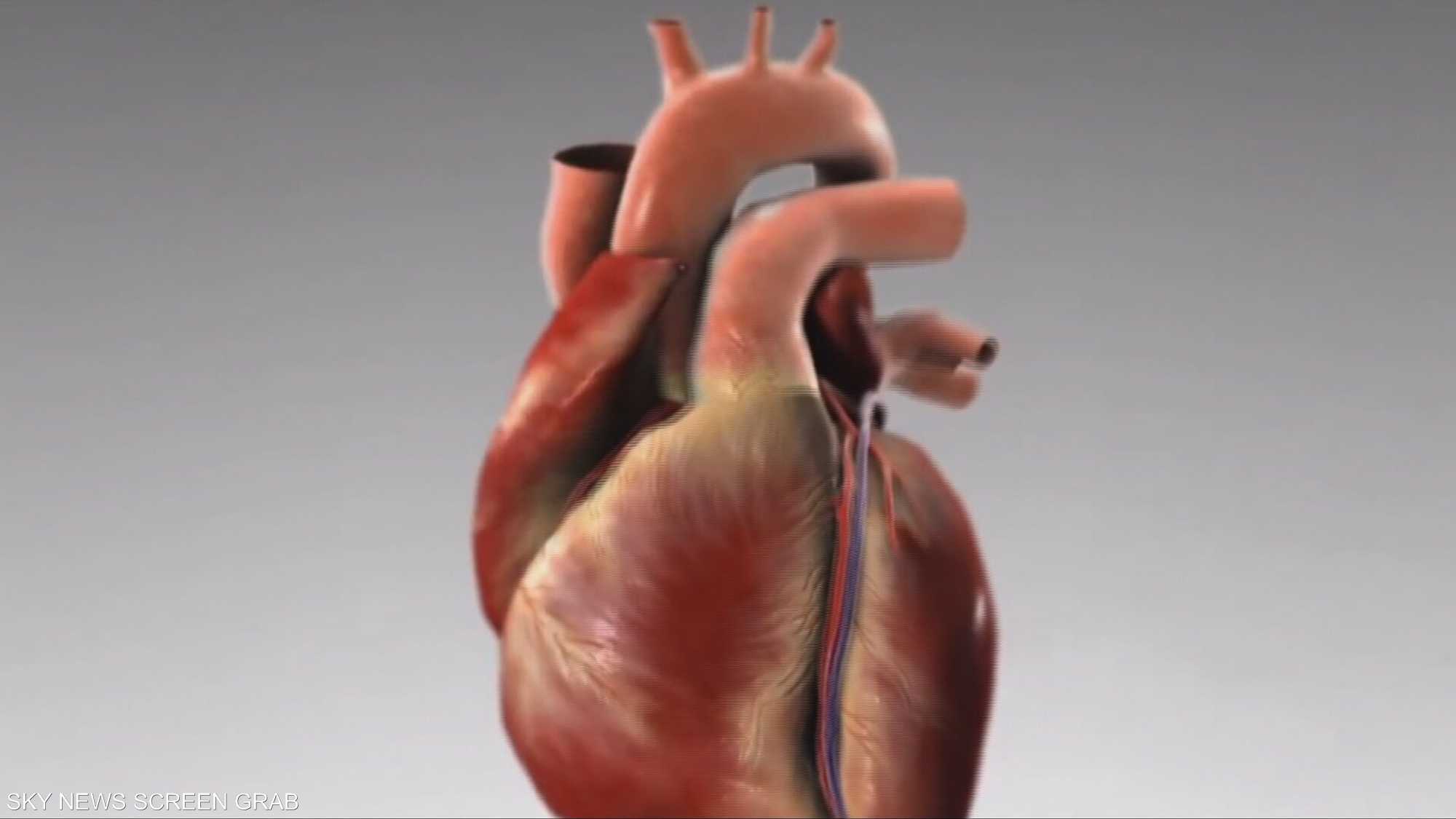 البدانة والتدخين أهم عوامل خطر الإصابة بفشل القلب