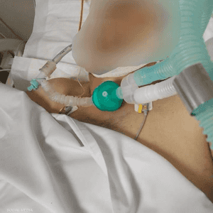 نقل الضحية إلى المستشفى لكنه توفي في وقت لاحق