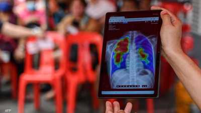 الصحة العالمية: وفاة أكثر من مليون شخص بهذا المرض