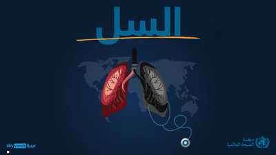 الصحة العالمية تكشف عن "أخطر الأمراض المعدية فتكا" في العالم