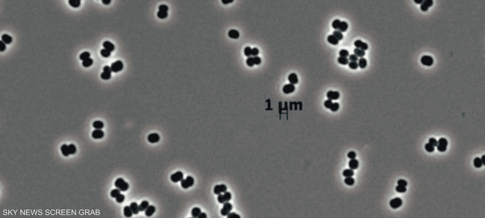 البكتيريا تتظاهر بالموت
