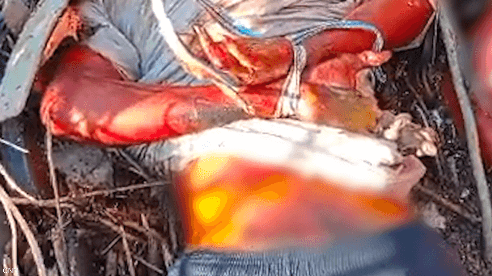 أحدهم على الأقل مقيد اليدين خلف ظهره