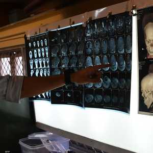 أرشيفية لمسح دماغ