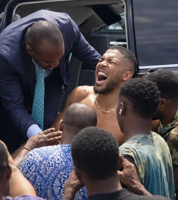 جوشوا تعرض لإصابات طفيفة