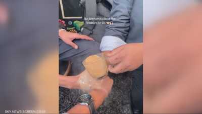 تريند "الماء المغلي" يتصدر تيك توك وسط تحذيرات من خطورته