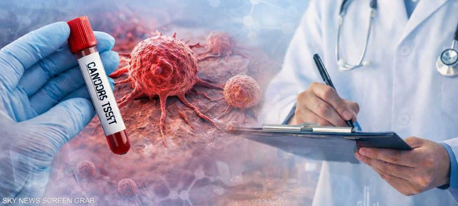 اليوم العالمي للسرطان.. الوقاية والطب الدقيق أساس النجاح