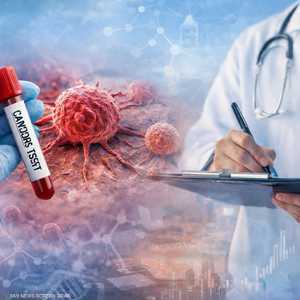 اليوم العالمي للسرطان.. الوقاية والطب الدقيق أساس النجاح